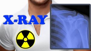 X-Ray Filter Photo 3